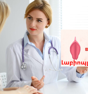 Սեռական շուրթերի ասիմետրիա:Լաբիոպլաստիկա: