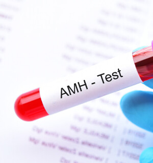 AMH հորմոն:Ի՞նչ է դա և ի՞նչ նշանակություն ունի գինեկոլոգիայում