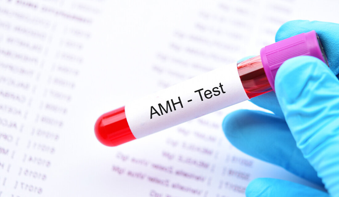 AMH հորմոն:Ի՞նչ է դա և ի՞նչ նշանակություն ունի գինեկոլոգիայում